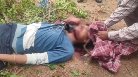 पेड़ काटते वक्त हुआ दर्दनाक हादसा, युवक के गले पर चल गई कटर मशीन, मौके पर हुई मौत